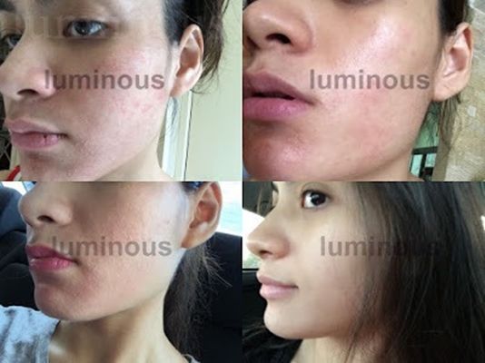 luminous skincare