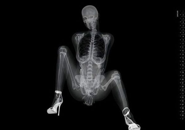 x ray seksi