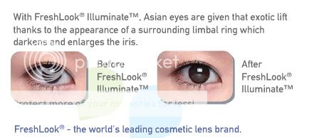 contact lens 